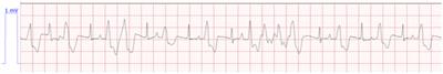 Case report: Resolution of oligo-anuric acute kidney injury with furosemide administration in a cat following lily toxicity